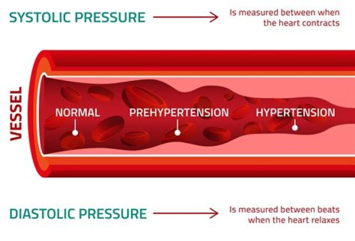 what causes high blood pressure systolic