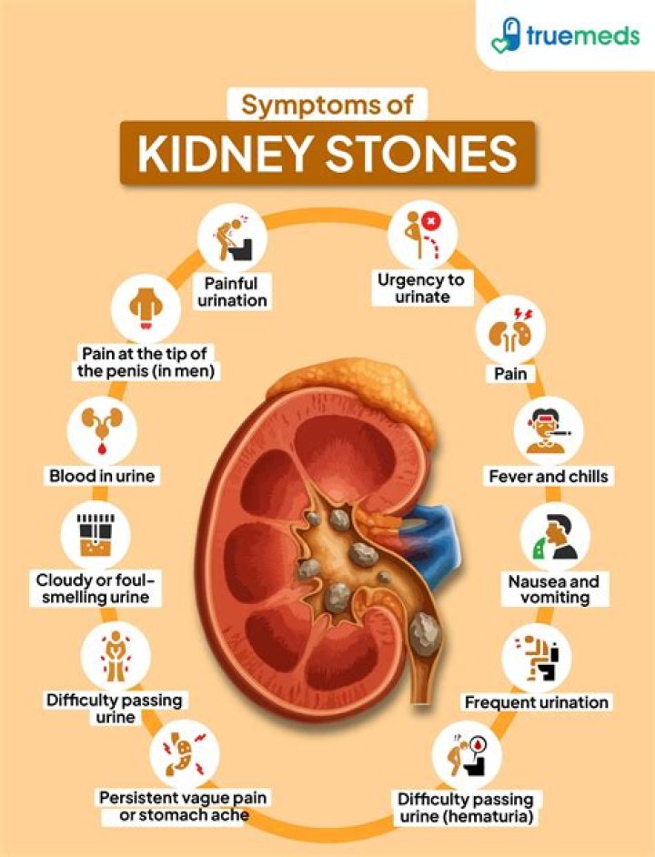 what causes kidney stones and gout