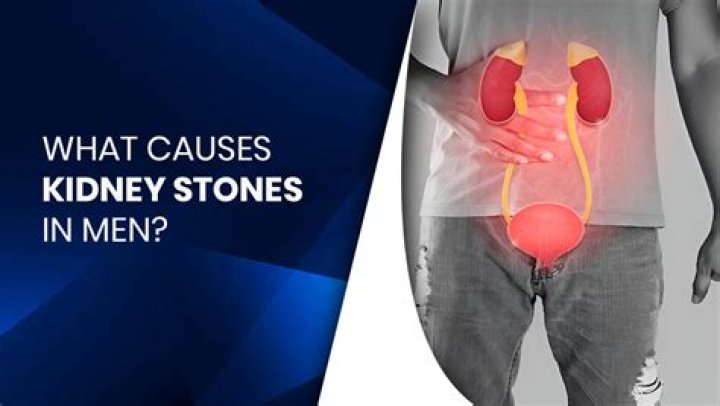 what causes kidney stones in men