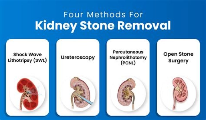 what causes pain after kidney stone removal