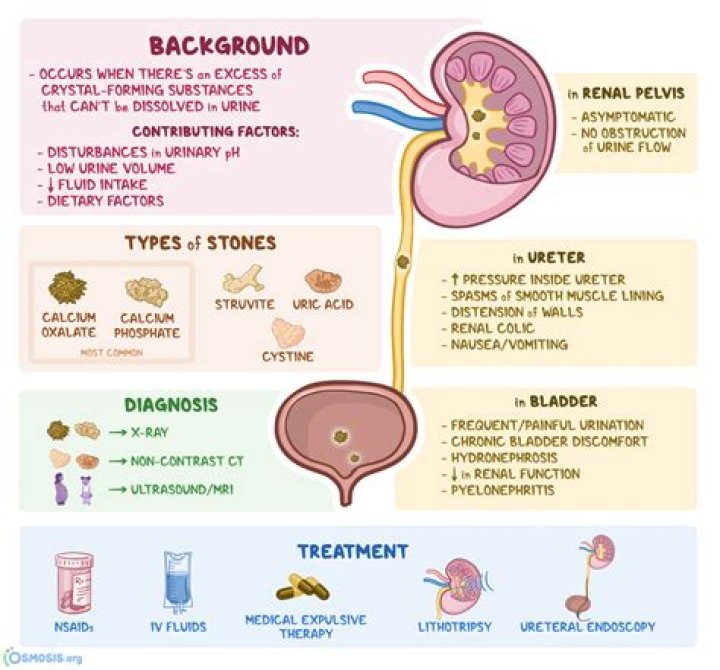 what causes renal stones