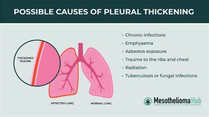 What causes thickening of the arteries