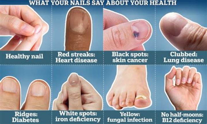 what color should your nails be