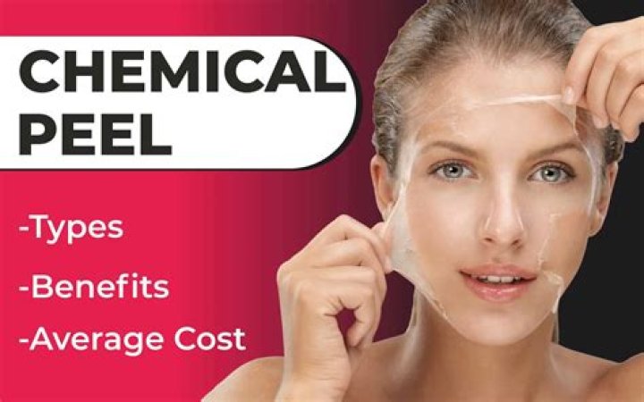 What does a PCA chemical peel do