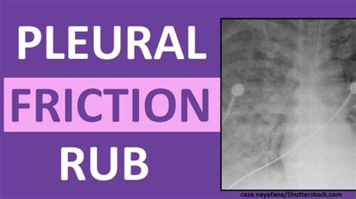 What does a pleural rub indicate