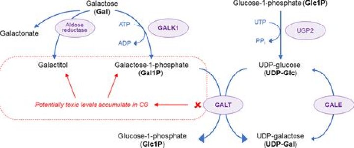 What does galactose-1-phosphate Uridyl transferase do?