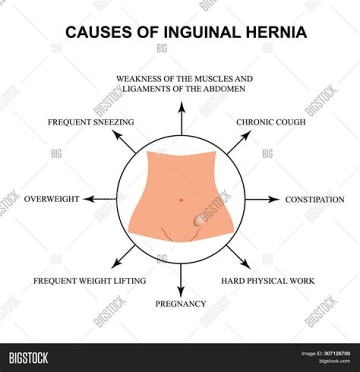 What does inguinal hernia look like?