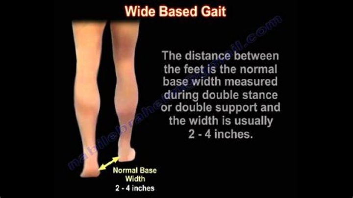 What does wide based gait mean?