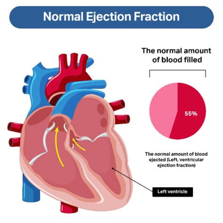 what is a dangerously low ejection fraction