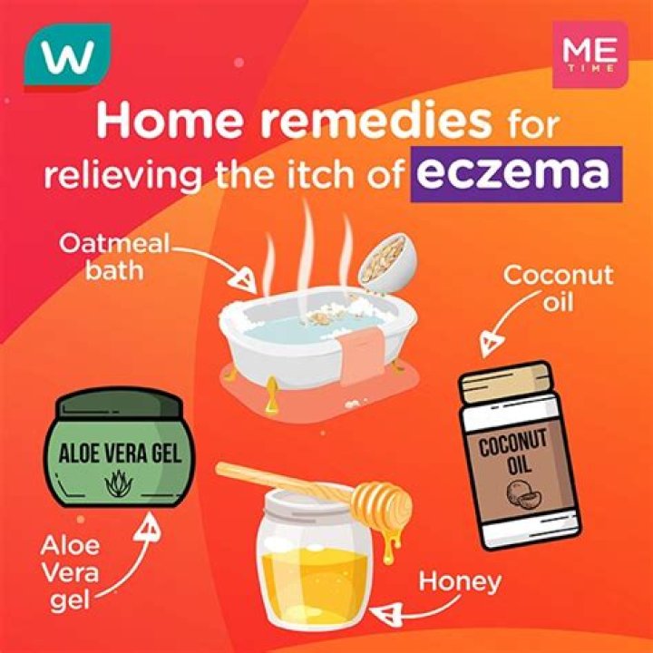What is a home remedy for eyelid eczema?