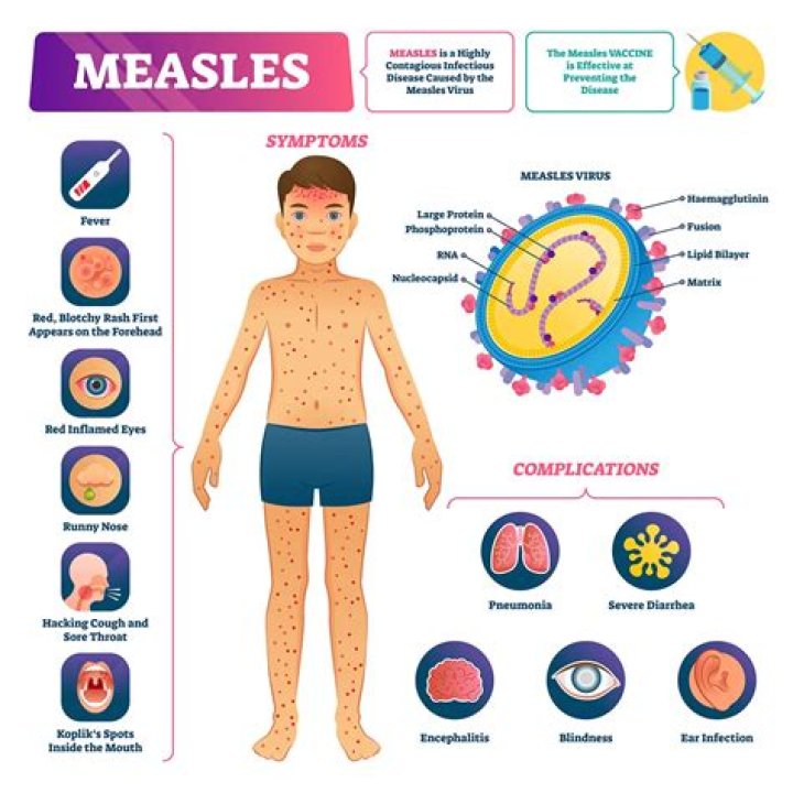 what is a potential complication of measles?