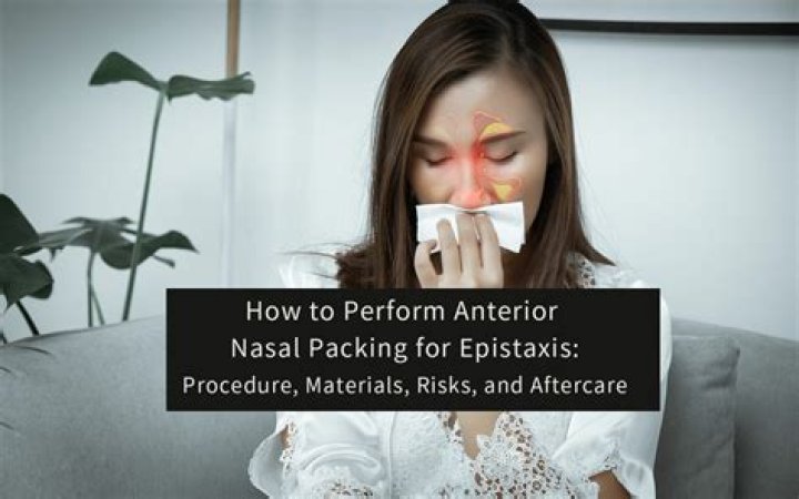 What is a rhino rocket for epistaxis