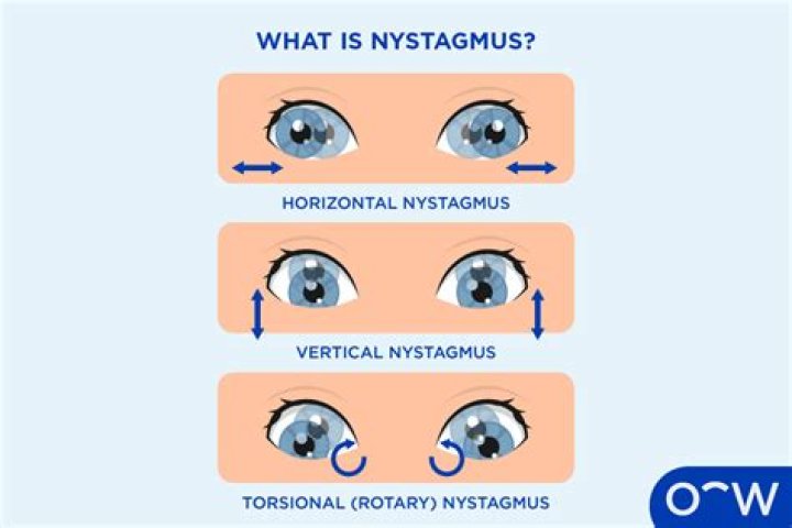 What is central positional nystagmus