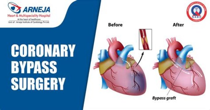 What is coronary bypass surgery and why is it performed