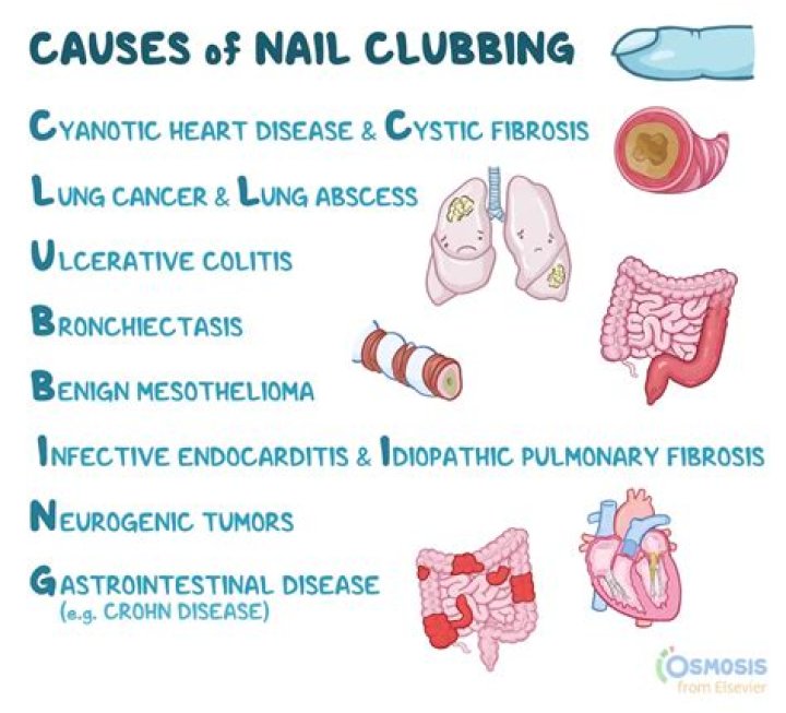 What is Cubbing in fox hunting
