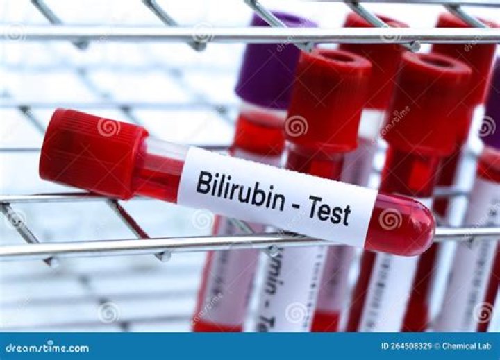 What is indirect bilirubin blood test