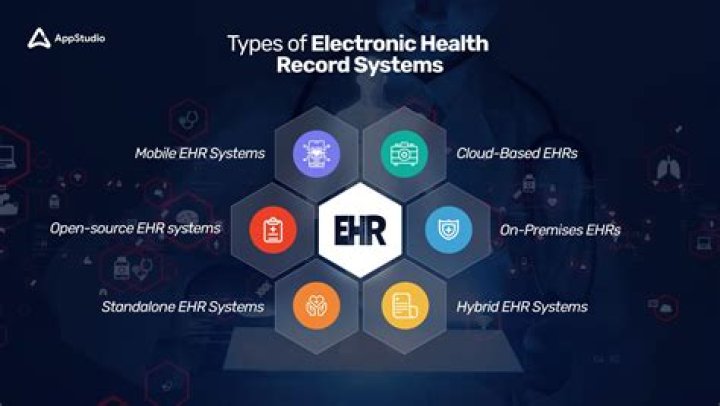 What is internal record system?
