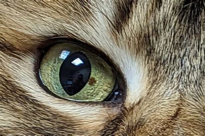 What is Melanosis in the eye?