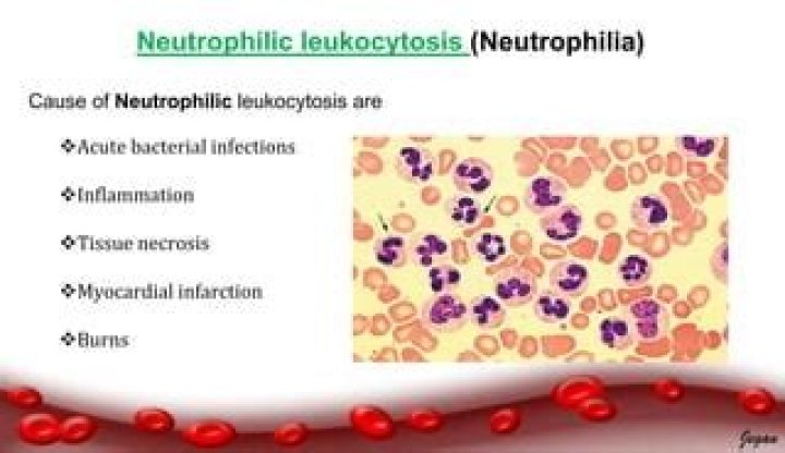 What is neutrophilic leukocytosis