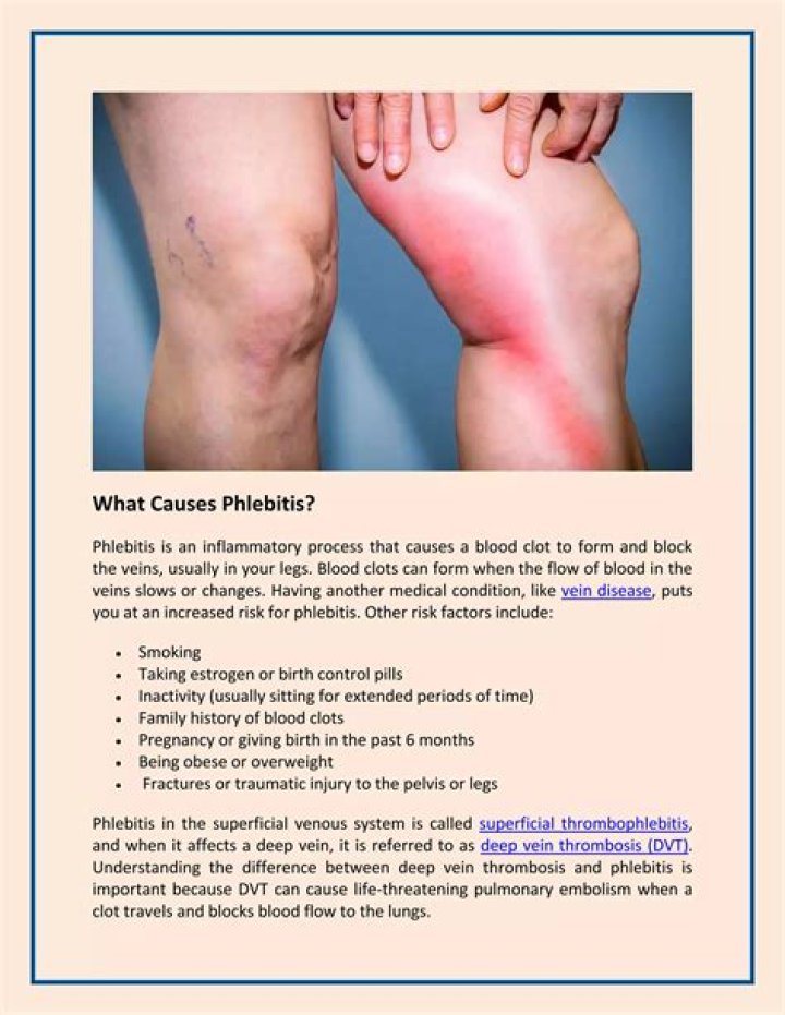 what is phlebitis