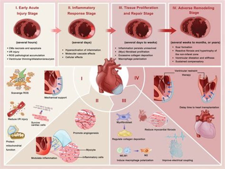 What is Provocable myocardial ischemia?