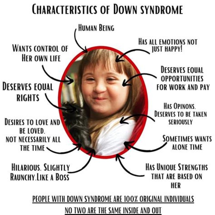 What is special about Down syndrome?