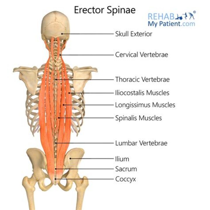 What is the action of erector spinae