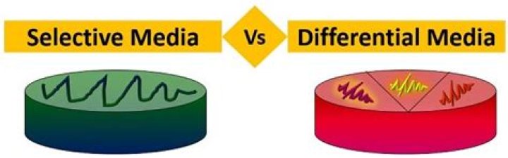 What is the definition of selective media