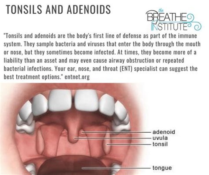 What is the difference between adenoids and tonsils
