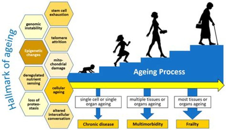 What is the major difference between primary aging and secondary aging quizlet