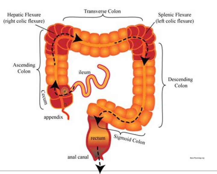 What is the surgical establishment of an opening into the colon?
