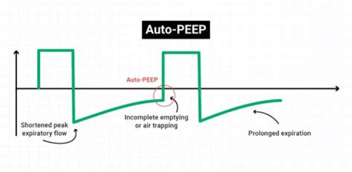 What patients are at greatest risk for auto PEEP