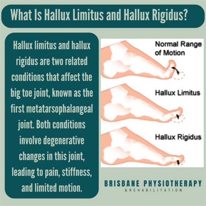 What toe number is the hallux?