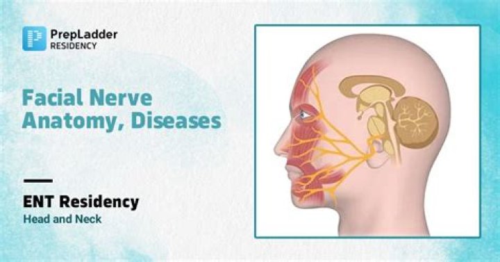 What type of nerve is facial nerve