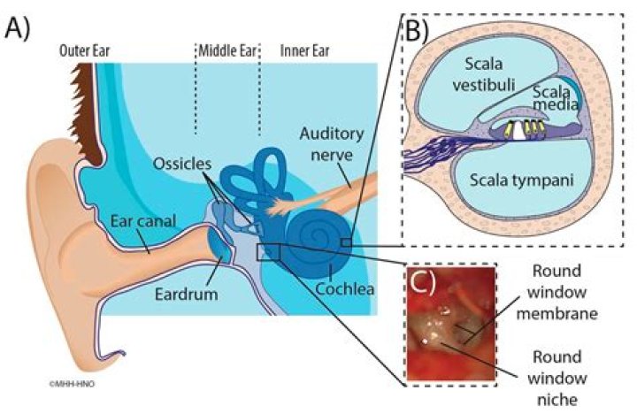 What word means incision into the eardrum
