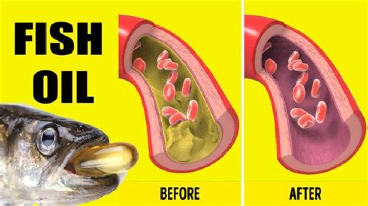 When should I stop taking fish oil before surgery