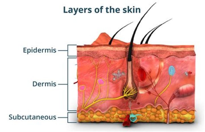 when tissue glue is used to close a wound involving the epidermis layer how is it reported?
