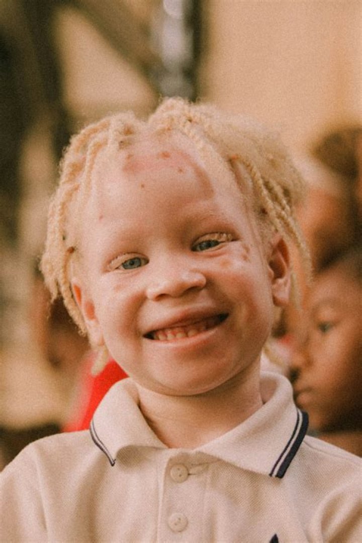 Where is albino island?