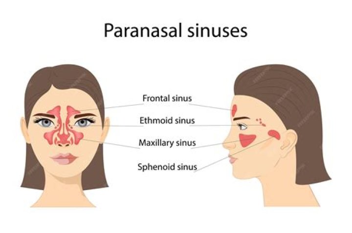 Which are the largest of the paranasal sinuses quizlet