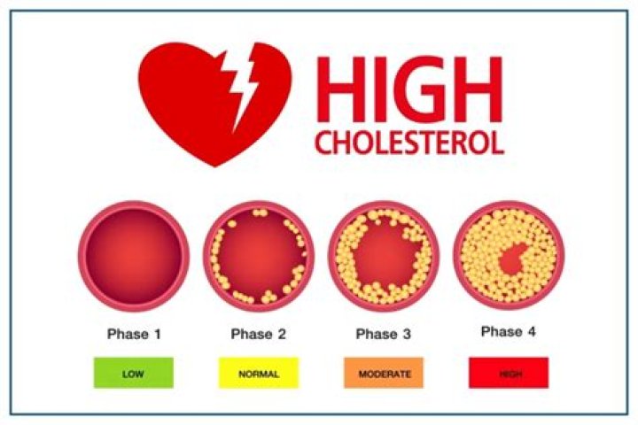 Which is worse cholesterol or sugar