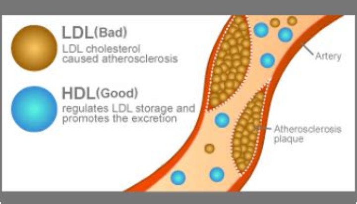 Why do doctors monitor LDL and HDL