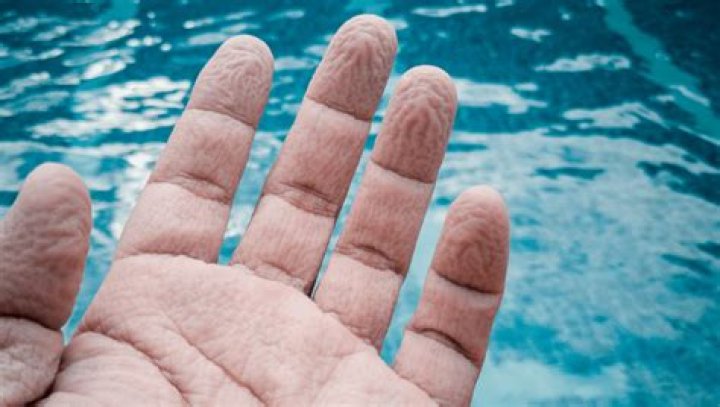 why do your fingers wrinkle in water osmosis