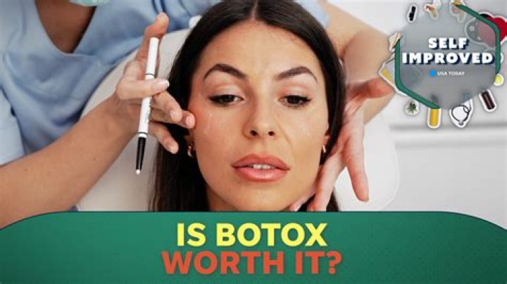 Why does Botox make people look like cats?