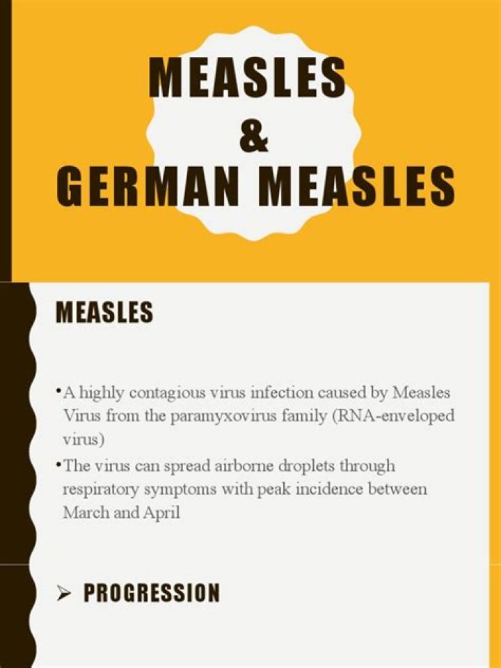 Why is it called German measles