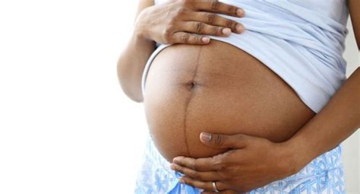 Why is my stomach black after pregnancy?