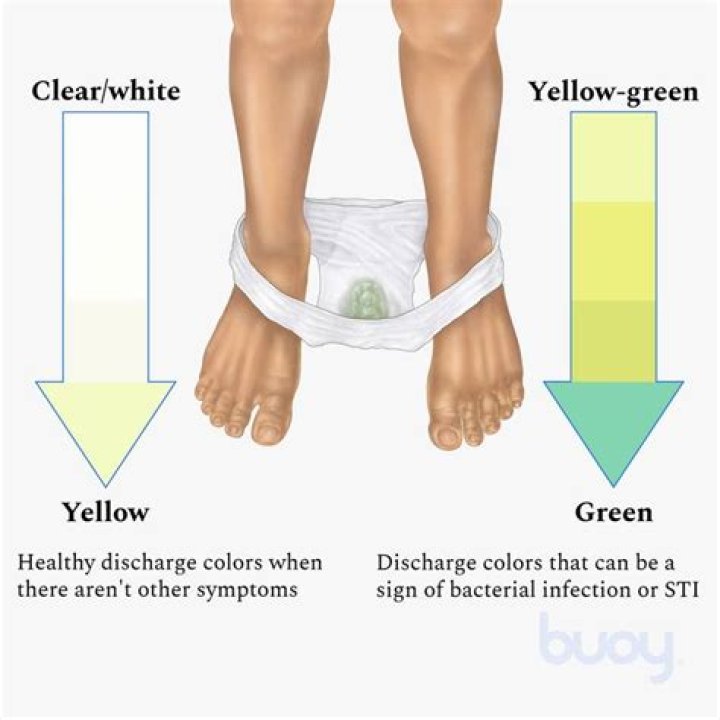 yellow green discharge